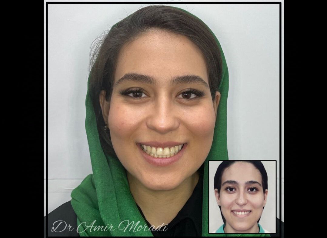 بیماره شماره 4